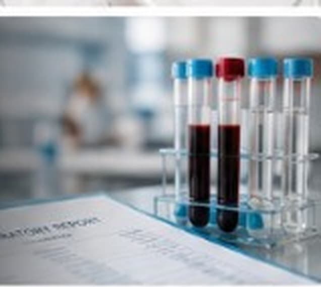 Blood collection tubes on a laboratory report