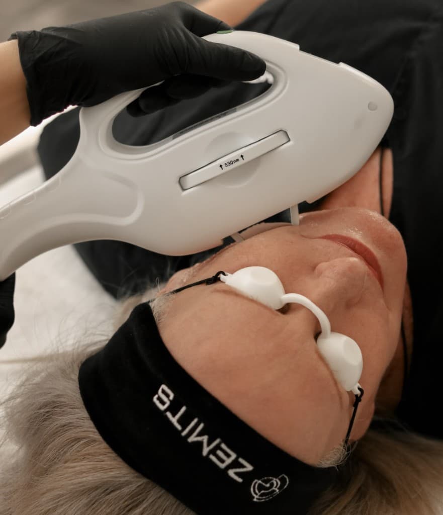 Lumecca IPL Photofacial treatment in Oswego IL at Hello Gorgeous Med Spa