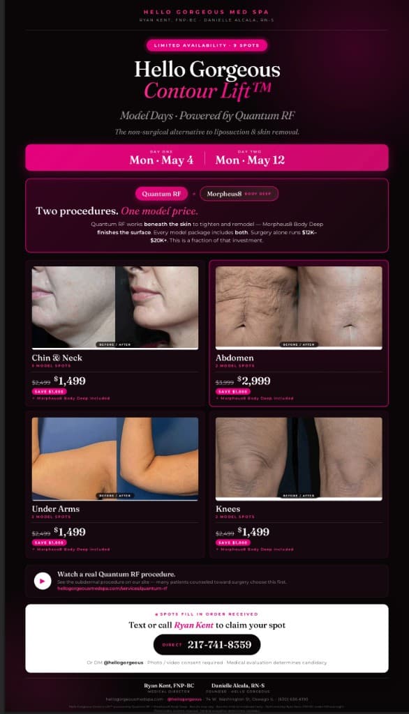 Hello Gorgeous Contour Lift Model Days flyer — Quantum RF and Morpheus8 Body Deep model pricing for chin, neck, abdomen, arms, and knees, May 2026