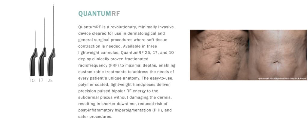 InMode QuantumRF handpieces and before/after education graphic