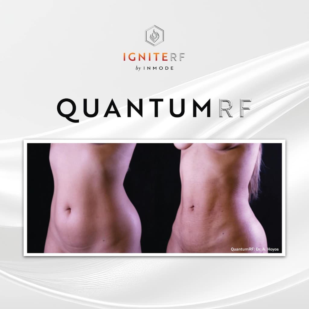 QuantumRF