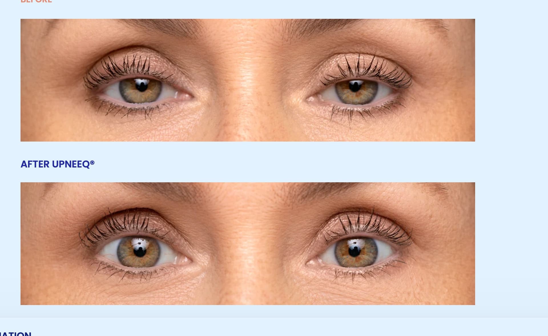 Woman with hazel eyes before and after Upneeq