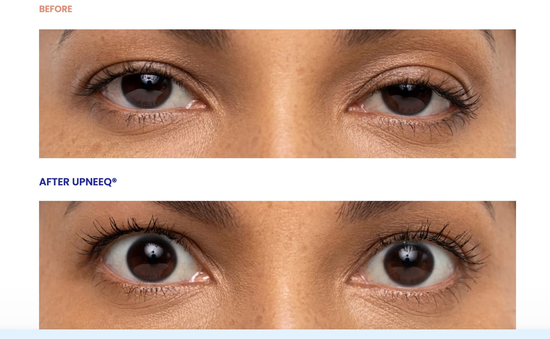 Upneeq before and after female eyes