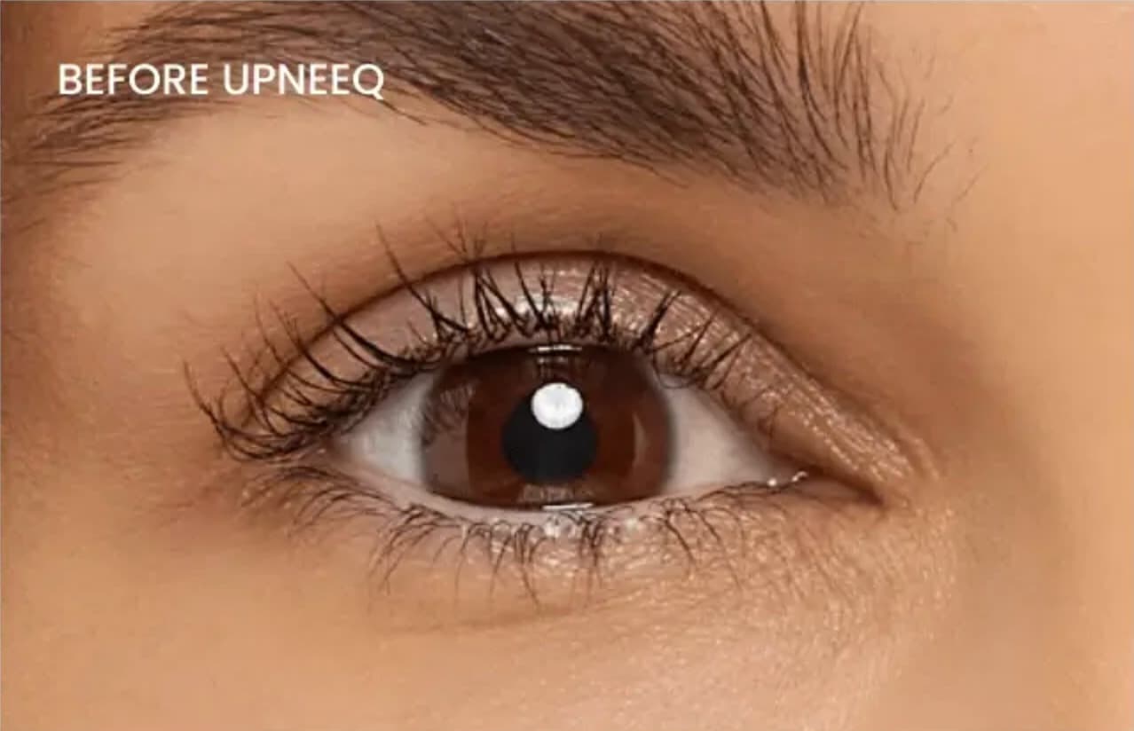 Upneeq before and after close up