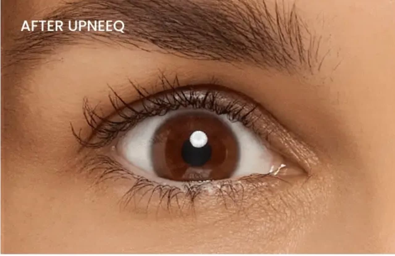 Upneeq eye lift result