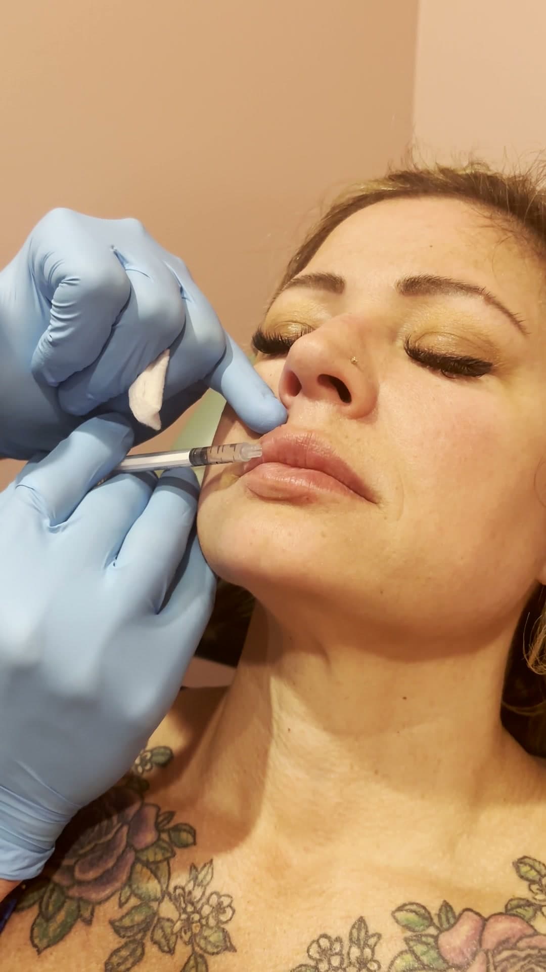 Botox clinic still 4 — Hello Gorgeous Med Spa Oswego
