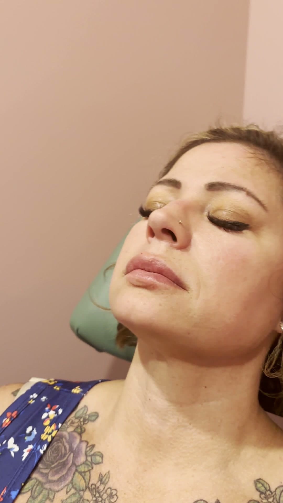 Botox clinic still 5 — Hello Gorgeous Med Spa Oswego