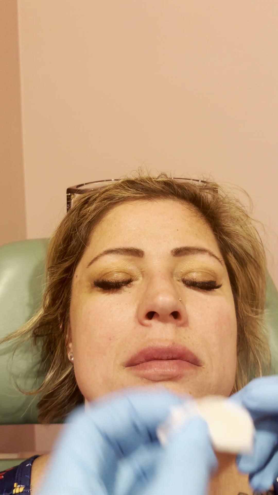 Botox clinic still 6 — Hello Gorgeous Med Spa Oswego