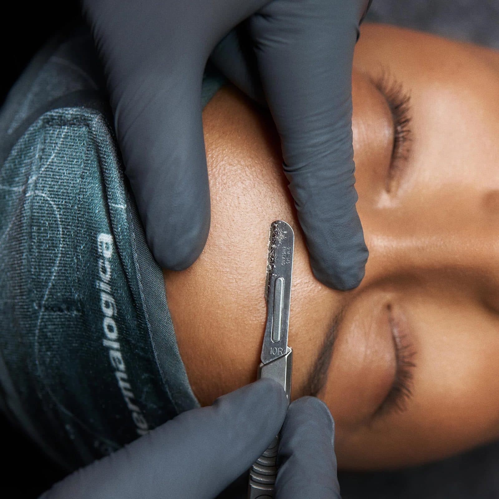 Dermaplaning & Exfoliation at Hello Gorgeous Med Spa