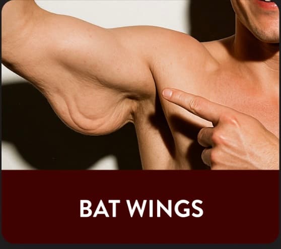 Arm skin tightening for bat wings