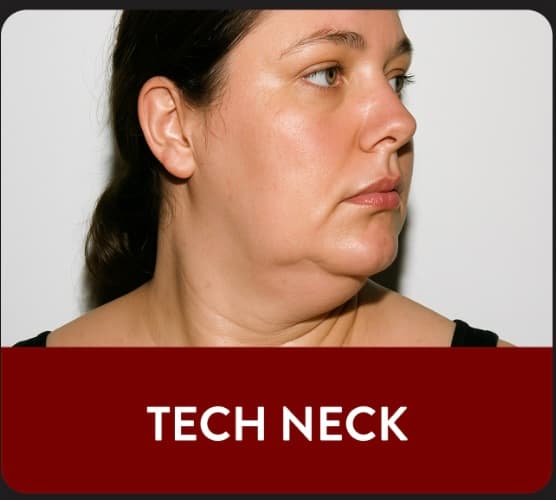 Abdomen skin tightening