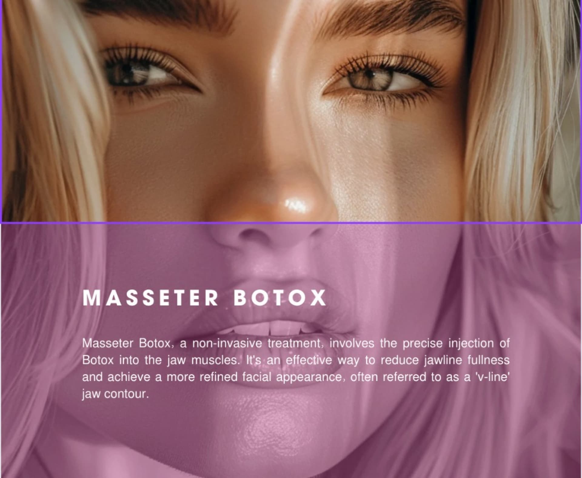 Masseter Botox
