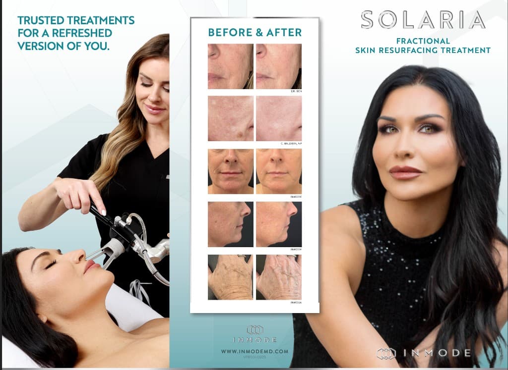InMode Solaria fractional skin resurfacing before and after results
