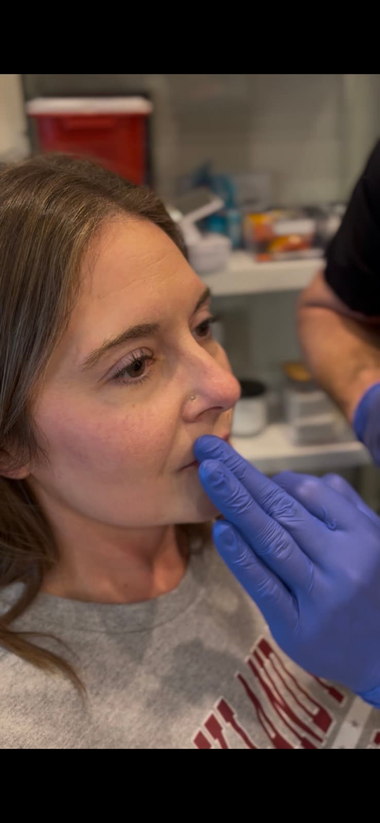 Close-up of a guest during a treatment at Hello Gorgeous Med Spa