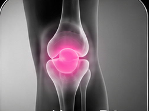 Knee x-ray