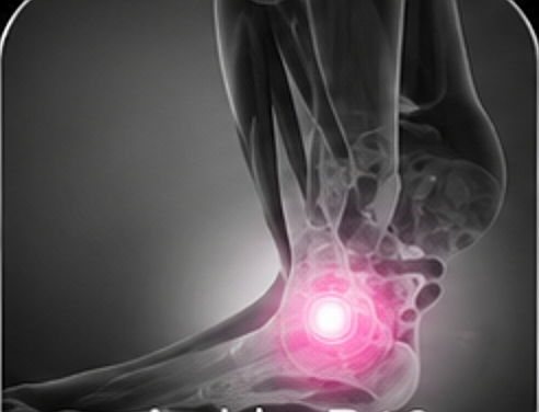 Ankle x-ray