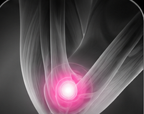 Elbow x-ray