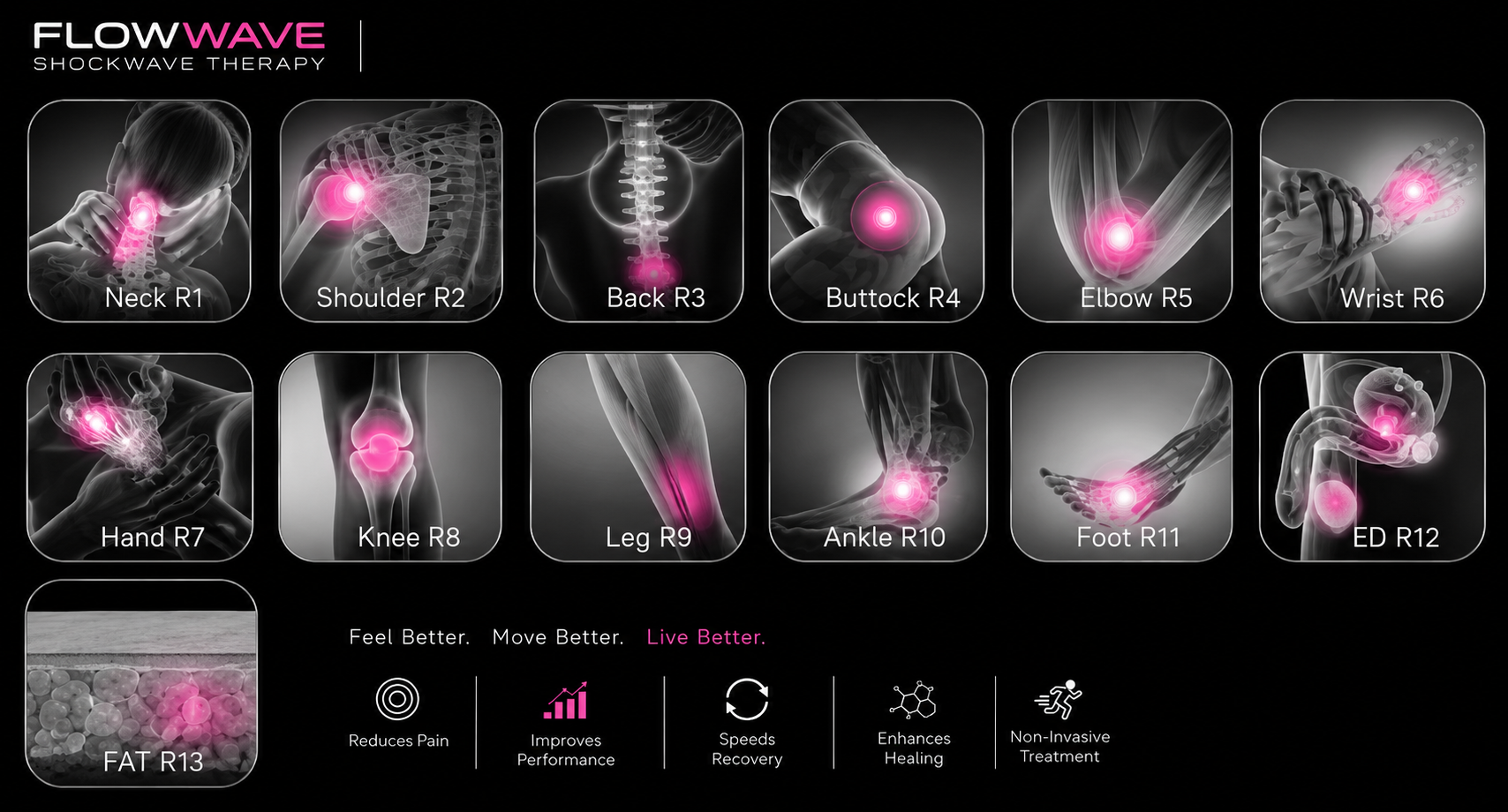FlowWave Shockwave Therapy treatment zones — neck, shoulder, back, knee, ankle and more