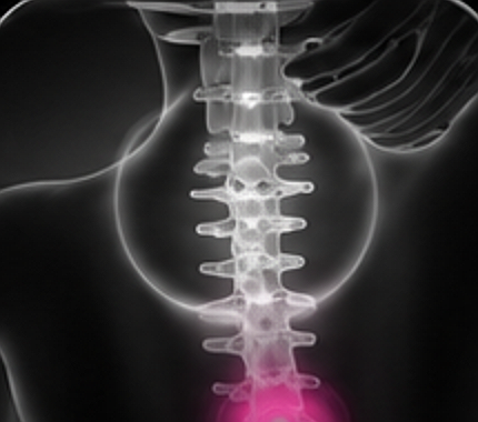 Back x-ray
