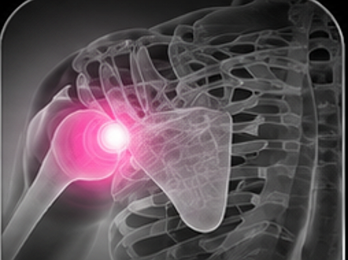 Shoulder x-ray