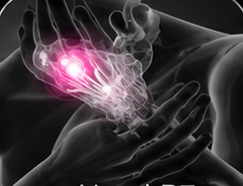 Hand x-ray