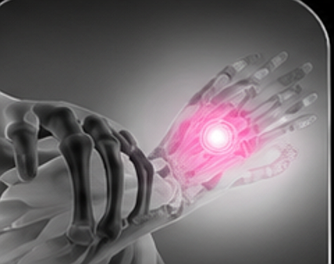 Wrist x-ray
